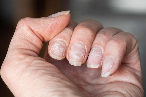 Comment réparer un ongle endommagé: Conseils et astuces